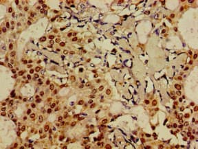 FOXA1 Antibody