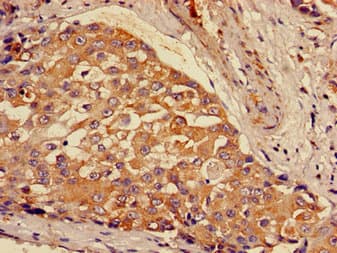 Polyclonal Rabbit anti-Human GCLM Antibody (IHC, IF, WB)