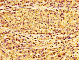 Polyclonal Rabbit anti-Human HIST1H1E Antibody (IHC)