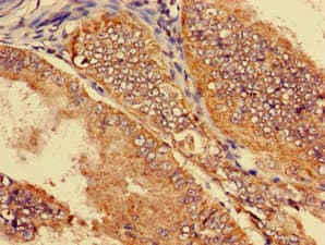SLC22A2 Antibody