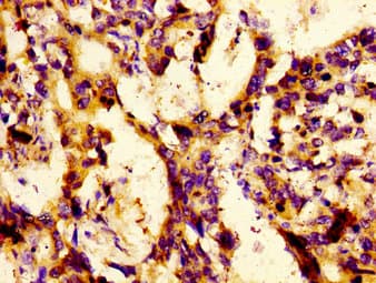 Polyclonal Rabbit anti-Human LBP Antibody (IHC)