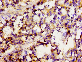 SLC22A1 Antibody