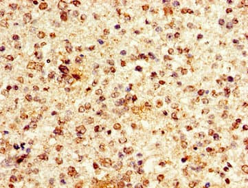 Polyclonal Rabbit anti-Human HIST1H1E Antibody (IHC)