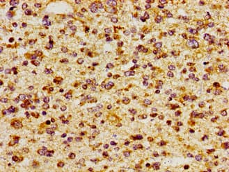Polyclonal Rabbit anti-Human ITGAV/Integrin Alpha V/CD51 Antibody (IHC, IF, WB)