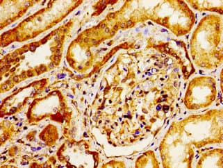 Polyclonal Rabbit anti-Human ITGAV/Integrin Alpha V/CD51 Antibody (IHC, IF, WB)