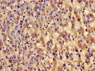 Polyclonal Rabbit anti-Human GCLM Antibody (IHC, IF, WB)
