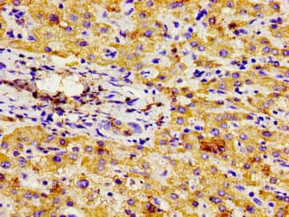 Polyclonal Rabbit anti-Human NPR3 Antibody (IHC)