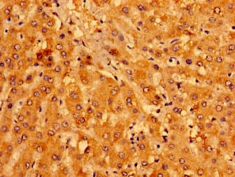 MCAT Antibody