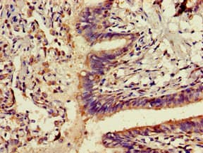 Polyclonal Rabbit anti-Human ADK / Adenosine Kinase Antibody (IHC, IF, WB)