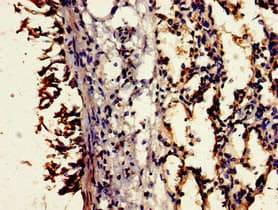 Polyclonal Rabbit anti-Human CD55 Antibody (IHC, IF)