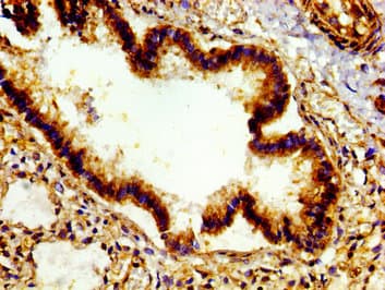 Polyclonal Rabbit anti-Human E2F4 Antibody (IHC)