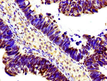 Polyclonal Rabbit anti-Human HIST1H1E Antibody (IHC, IF, WB)