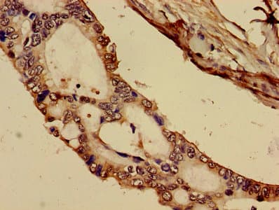 Polyclonal Rabbit anti-Human Complement C1R Antibody (IHC, IF, WB)