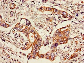Polyclonal Rabbit anti-Human STAT6 Antibody (IHC, IF)