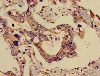 Polyclonal Rabbit anti-Human ADK / Adenosine Kinase Antibody (IHC, IF, WB)