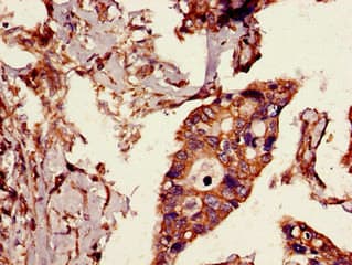 CYLD Antibody