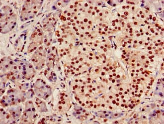 AGPAT5 Antibody