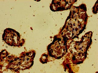CARD14 Antibody