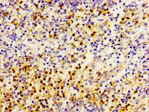 Polyclonal Rabbit anti-Human PRTN3 / Myeloblastin Antibody (IHC)