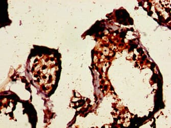 Polyclonal Rabbit anti-Human CCNE1 / Cyclin E1 Antibody (IHC, WB)