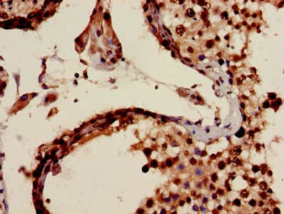 Polyclonal Rabbit anti-Human MIA / CD-RAP Antibody (IHC)