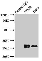 Polyclonal Rabbit anti-Human NQO2 Antibody (IHC, IF, WB)