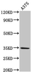 Polyclonal Rabbit anti-Human MC1R Antibody (IHC, WB)