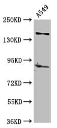 Polyclonal Rabbit anti-Human AFF2 / OX19 Antibody (WB)