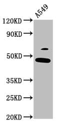 FOXL2 Antibody