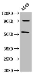LEMD2 Antibody
