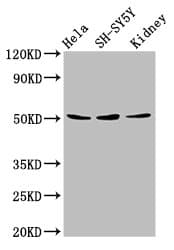 Polyclonal Rabbit anti-Human RARG / RAR-Gamma Antibody (IHC, WB)