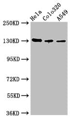 Polyclonal Rabbit anti-Human ITGAV/Integrin Alpha V/CD51 Antibody (IHC, IF, WB)
