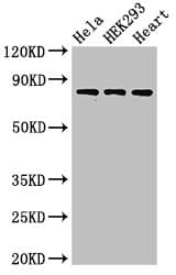 Polyclonal Rabbit anti-Human Complement C1R Antibody (IHC, IF, WB)