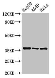 ECH1 Antibody
