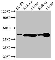Polyclonal Rabbit anti-Human ADK / Adenosine Kinase Antibody (IHC, IF, WB)