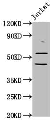 Polyclonal Rabbit anti-Human CHRNB2 Antibody (IF, WB)