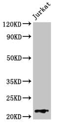 Polyclonal Rabbit anti-Human HIST1H1C Antibody (IHC, IF, WB)