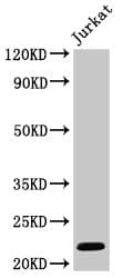 Polyclonal Rabbit anti-Human HIST1H1C Antibody (IF, WB)