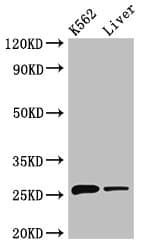 Polyclonal Rabbit anti-Human NQO2 Antibody (IHC, IF, WB)
