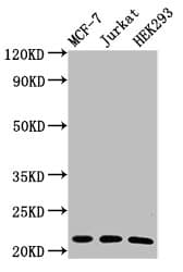 Polyclonal Rabbit anti-Human HIST1H1C Antibody (WB)