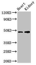 Polyclonal Rabbit anti-Human CCNE1 / Cyclin E1 Antibody (IHC, WB)