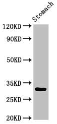 Polyclonal Rabbit anti-Human GCLM Antibody (IHC, IF, WB)