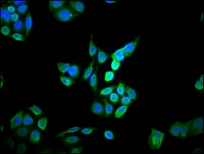 DOHH Antibody