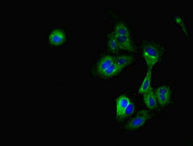 CRIP2 Antibody