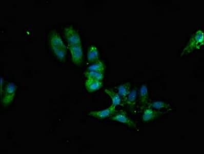 PPP2R2A Antibody