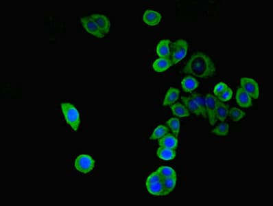 WNK4 Antibody