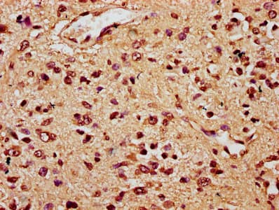 TCF20 Antibody
