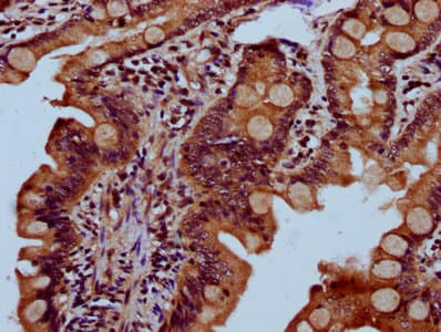 SEC23B Antibody