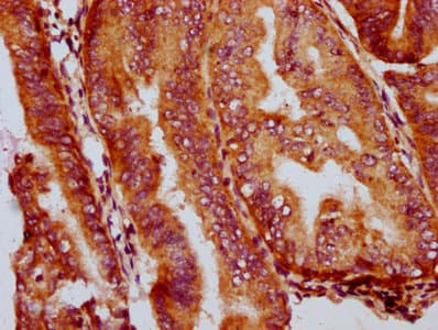 GSDMA Antibody