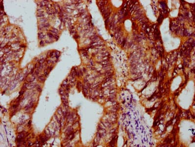 DYM Antibody